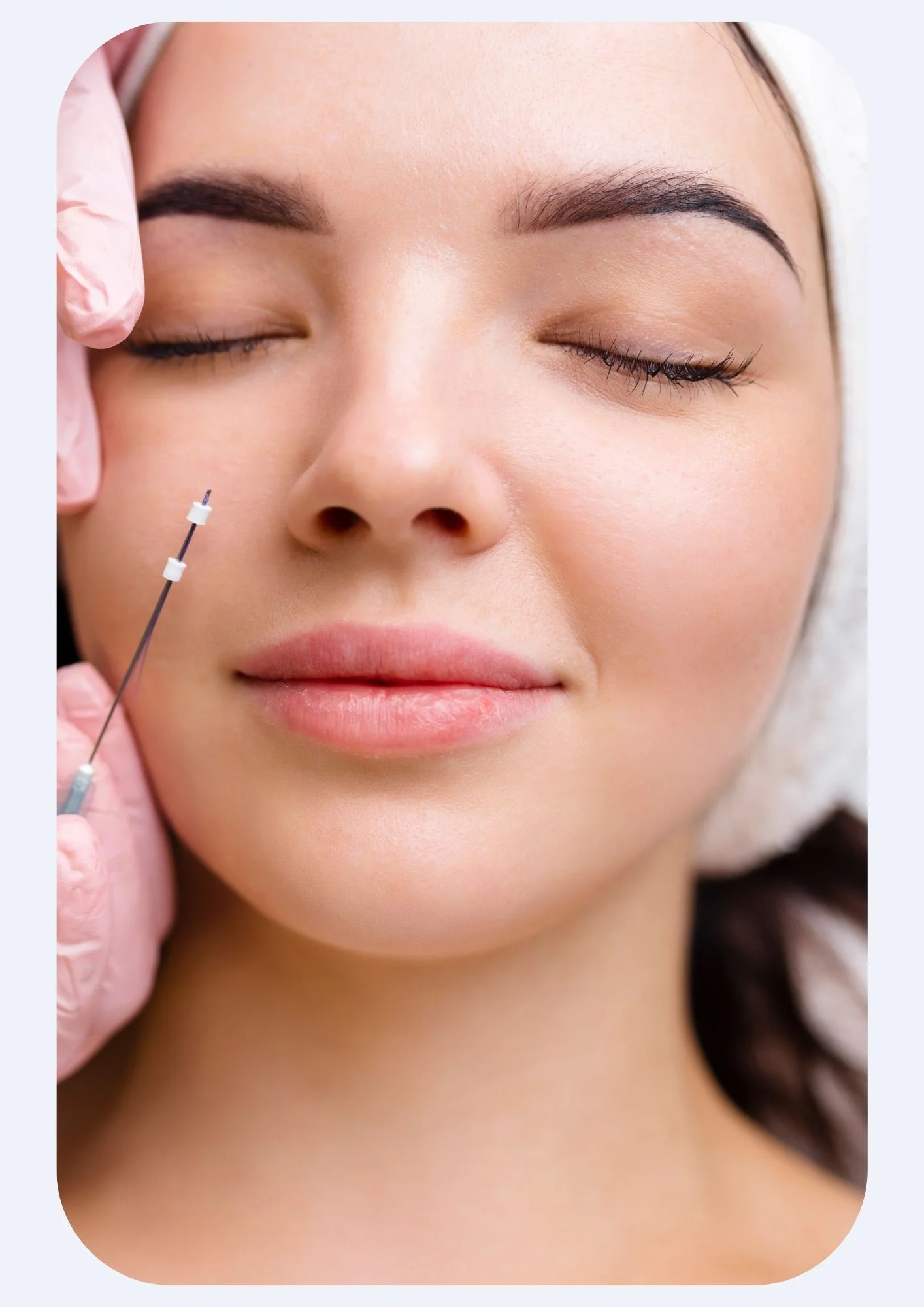 THREADLIFTING
