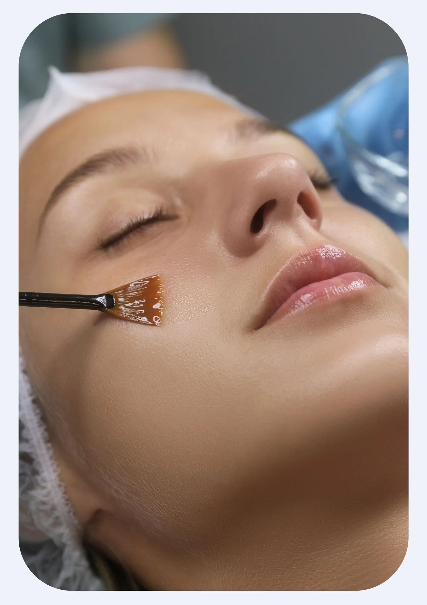 ACNE/MELA PEELING
